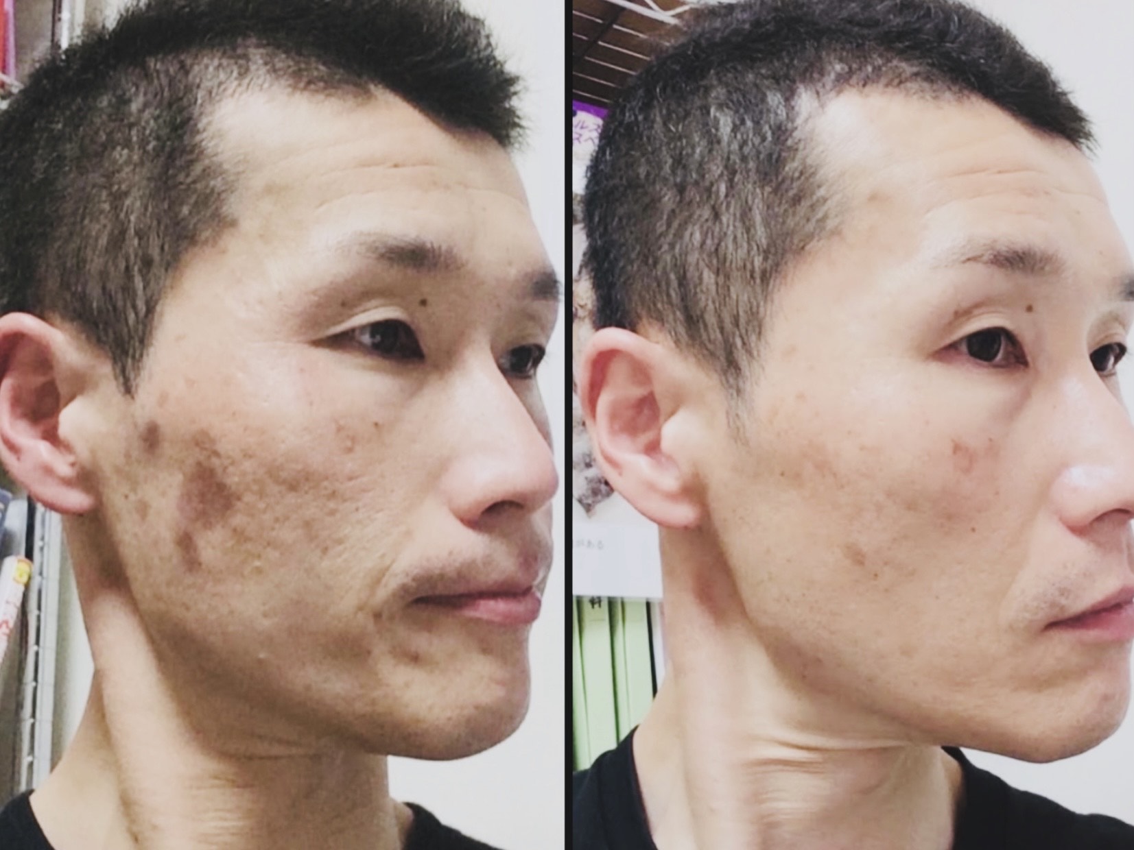 メニュー②1発で健康になる セット ¥600000(月々15000)